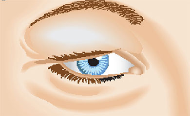 eyelid disease blepharitis